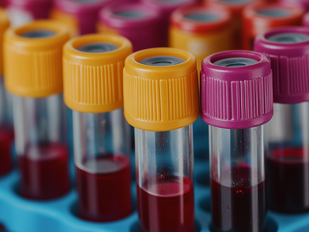 Close-up of test tubes filled with dark red liquid, some capped in yellow and others in purple, placed in a blue holder.